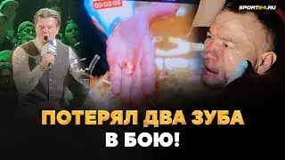 РЕГБИСТ В ЭКСТАЗЕ! БОЙ ГОДА НА TOP DOG / Потерял два зуба, но дрался