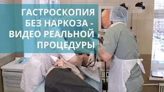 💡 Гастроскопия без наркоза: подготовка и проведение процедуры. Гастроскопия без наркоза видео. 18+