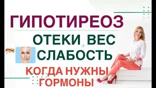 💊 СЛАБОСТЬ❓ ОТЕКИ❓ НАБОР ВЕСА❓- ГИПОТИРЕОЗ: КОГДА ВВОДИТЬ ГОРМОНЫ❓ Врач эндокринолог Ольга Павлова