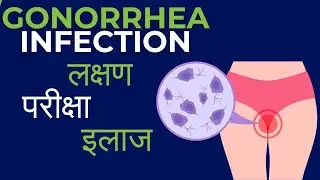 Gonorrhea symptoms in men | Gonorrhea kya hota hai | kaise hota hai | Diagnosis and treatment