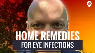 Home Remedies for an Eye Infection