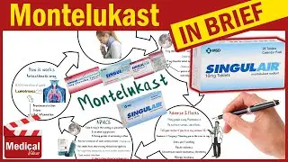 Montelukast 10 mg ( Singulair ): What is Montelukast Used For, Dosage, Side Effects & Precautions?