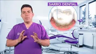 🧐 ¿Sabes qué es el SARRO DENTAL?