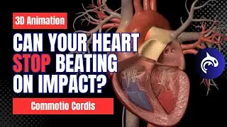 Commotio Cordis (Cardiac Arrest from a Blow to the Chest) - 3D Animation