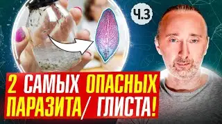 Эти паразиты смертельно ОПАСНЫ, вызывают даже РАК!