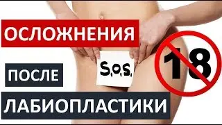 ❗️🔞ОСЛОЖНЕНИЯ ПОСЛЕ ЛАБИОПЛАСТИКИ  ❗️🔞ТОЛЬКО 18+