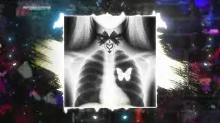 nightfxrce x dvspair 