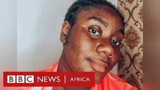 What is hirsutism and how I learned to live with it - BBC Africa