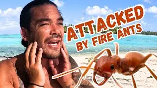 SEVERE ALLERGIC REACTION on a DESERTED ISLAND! -  (Episode 238)