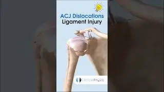 ACJ Dislocations: Which Ligaments Are Injured? #physicaltherapy #physiotherapy