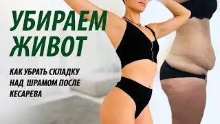 Как убрать складку на животе. Как убрать складку на животе после кесарева.Как убрать живот.