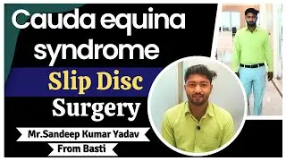 Cauda equina syndrome Slip Disc Surgery ||  Slip Disc Treatment in India