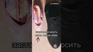 Деревня с маленькими ногами