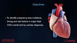 UOG Video Abstract: Pregnancy loss in cases with major fetal congenital heart disease