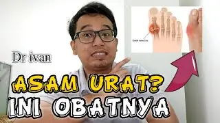 KAPAN HARUS MINUM OBAT UNTUK ASAM URAT?