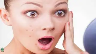 Use of patch to remove acnes in 1 minute | Photoshop Now |