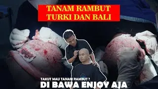 GAK PD KARENA BOTAK ?? || TANAM RAMBUT SOLUSINYA !!!