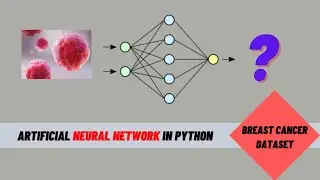 Artificial Neural Network (ANN) for Breast Cancer Dataset Classification in Python