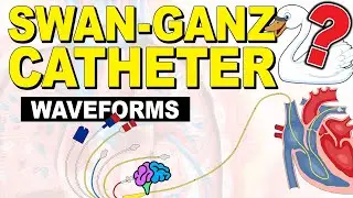 Pulmonary Artery (PA) Catheter Waveforms EXPLAINED!