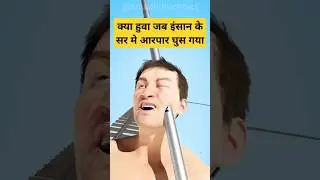 iron rod though the head|सिर में लोहे की रॉड घुस गई|#shorts  #facts