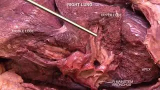 Right lung dissection (Lab) - Anatomy of the Chest, Abdomen, and Pelvis