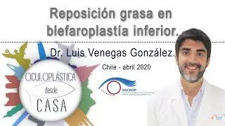 Reposición grasa en blefaroplastía inferior, Dr. Luis Venegas G.
