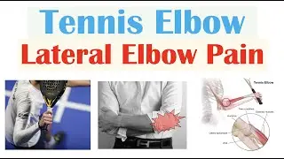 Tennis Elbow (Lateral Epicondylitis) | Causes, Pathophysiology, Symptoms, Diagnosis, Treatment