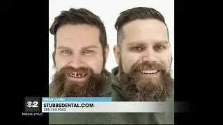 Permanent Teeth in 24 Hours with Stubbs Dental