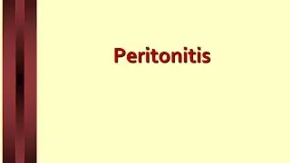 Lecture on Peritonitis