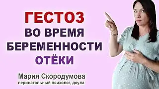 Почему опасен ГЕСТОЗ? Отеки при беременности.