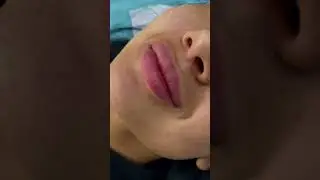 Губы обучение Москва , сразу после 