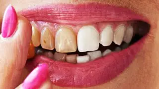 How to Whiten Teeth: Photoshop Tutorial | Color Manipulation