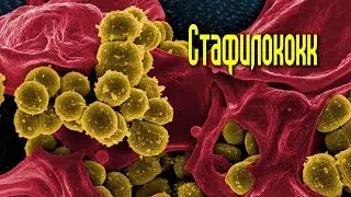 Действенное СРЕДСТВО от неизлечимого СТАФИЛОКОККА
