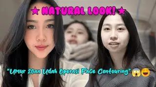 Natural Look!😍 Umur 20 an udah operasi Face Contouring!😱🤯