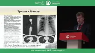 Торакальная радиология для эндоскопистов