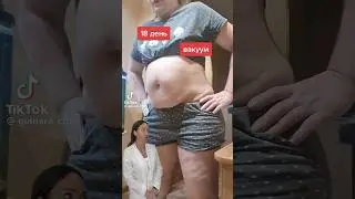 Делая Вакуум ты никогда не похудеешь 