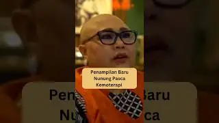 Nunung Srimulat Pasca Kemoterapi 