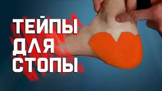 Как затейпировать плантарный фасциит (пяточную шпору) самому себе?