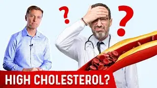 Dr. Berg's Wife Has Crazy High Cholesterol of 261..