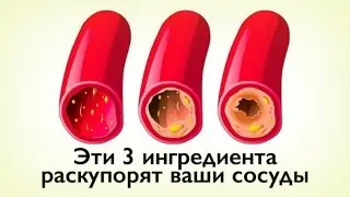 КАК ОЧИСТИТЬ СОСУДЫ С ПОМОЩЬЮ 3-Х ПРОДУКТОВ?