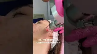 На что способна лазерная шлифовка на аппарате DEKA?