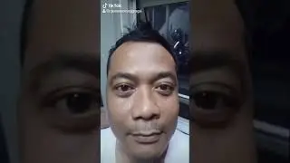 TikTok Toyota(3)