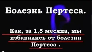 Болезнь Пертеса  Как избавиться от Болезни Пертеса