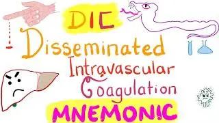 Disseminated Intravascular Coagulation (DIC) - Mnemonic - Hematology