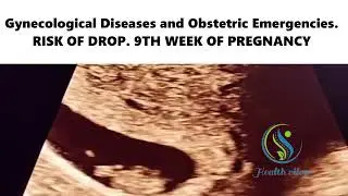 Gynecological Diseases and Obstetric Emergencies. RISK OF DROP. 9TH WEEK OF PREGNANCY  #ultrasound