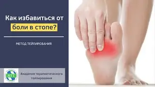 ✅ Боль в стопе. Как с помощью тейпирования помочь пациенту?