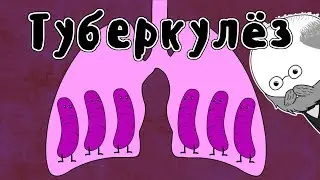 Лечение Туберкулеза - Мудреныч (Роберт Кох, история на пальцах)