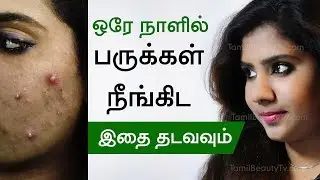 How to remove pimple? -  Home remedies for pimples - Beauty Tips in Tamil