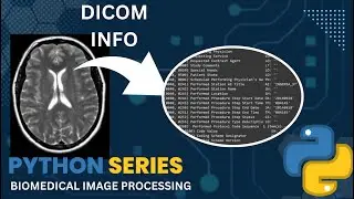 Dicom info in Python | Biomedical Image Processing