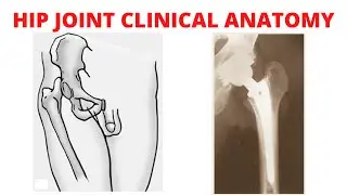 Hip Joint Clinical Anatomy| Trendelenburg Test| Surgical Hip Replacement| Arthritis| Hip dislocation